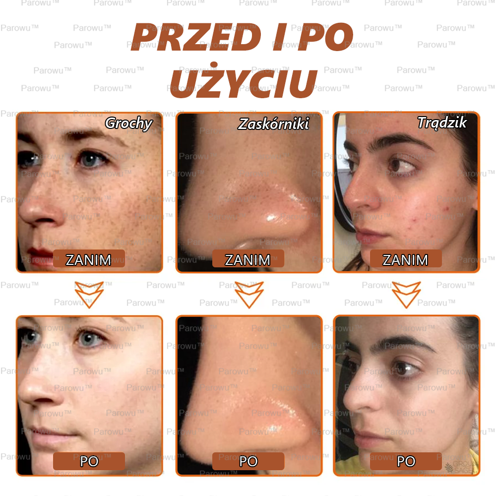Parowu™ Wybielająca i Rozjaśniająca Maska - Naturalne składniki trwale usuwają plamy, piegi i przebarwienia
