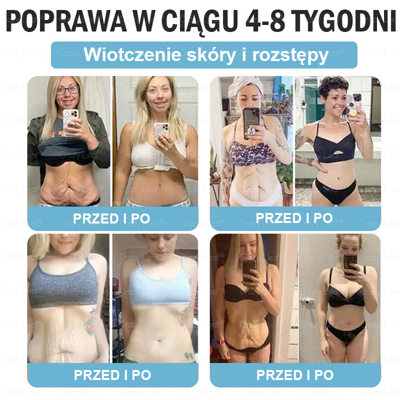 CrazyLeaf® Szczupłość i Witalność Tirzepatide – 🔁 doustny roztwór wspierający odchudzanie, ciśnienie i poziom cukru
