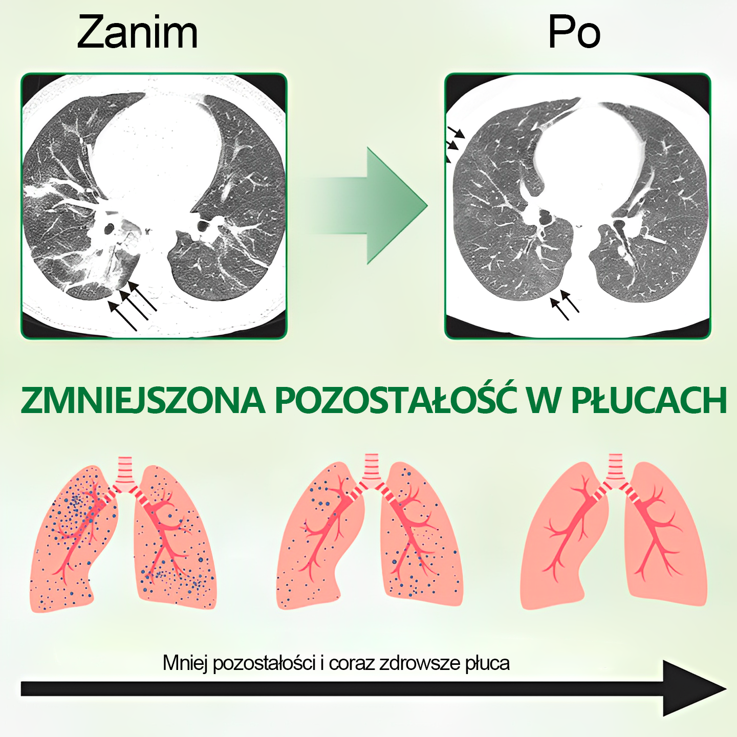 Gooyeer™ Zaawansowany spray do oczyszczania płuc – zdrowe płuca, wsparcie odporności, detoksykacja i łatwiejsze oddychanie – Certyfikat CE