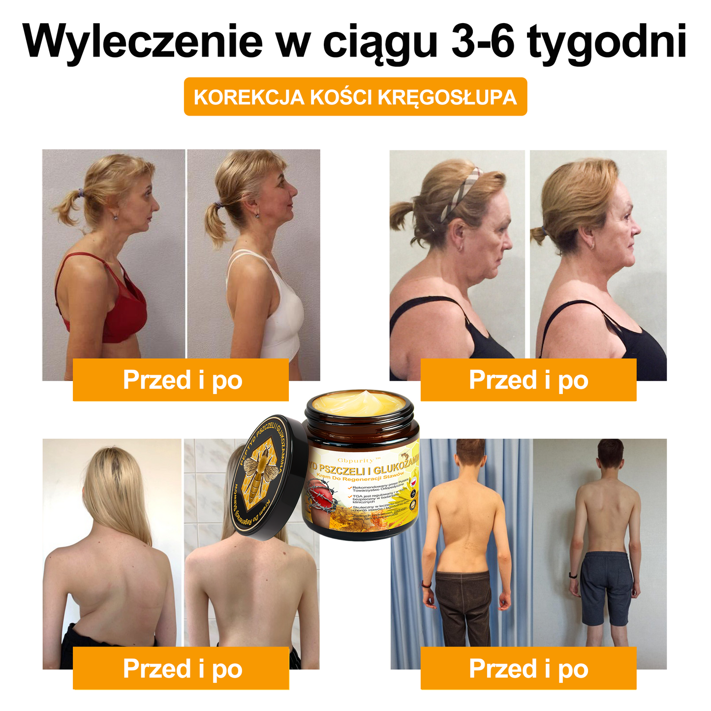 Gbpurity™ Krem Do Regeneracji Stawów | 🛡️ Dla osób w średnim i późnym wieku