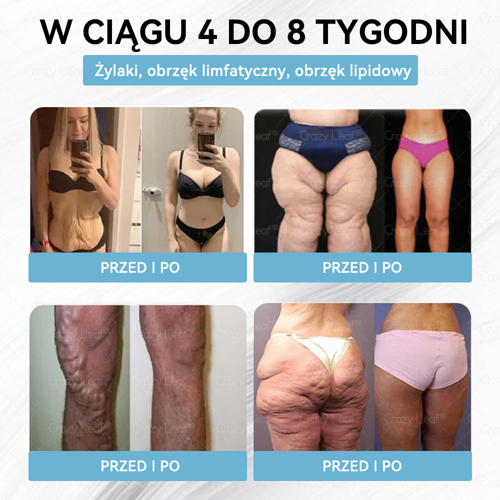 CrazyLeaf® Szczupłość i Witalność Tirzepatide – 🔁 doustny roztwór wspierający odchudzanie, ciśnienie i poziom cukru