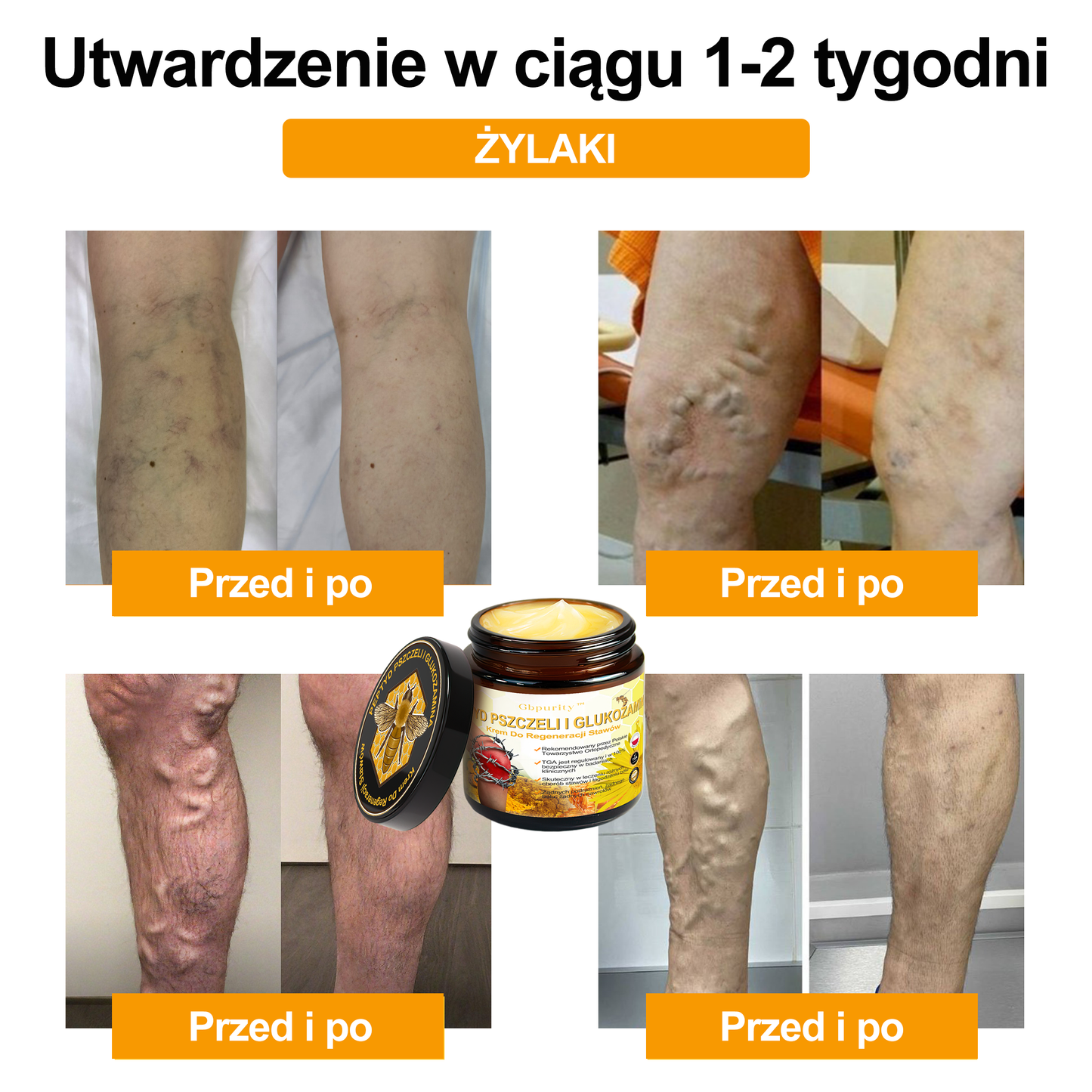 Gbpurity™ Krem Do Regeneracji Stawów | 🛡️ Dla osób w średnim i późnym wieku