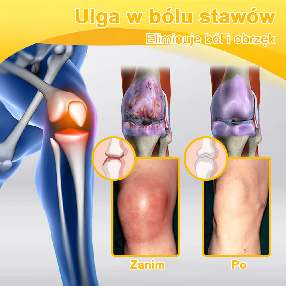 Gbpurity™ Krem Do Regeneracji Stawów | 🛡️ Dla osób w średnim i późnym wieku